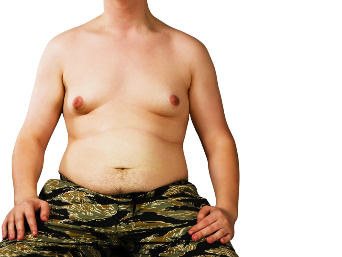 How Can You Get Rid of Gynecomastia?